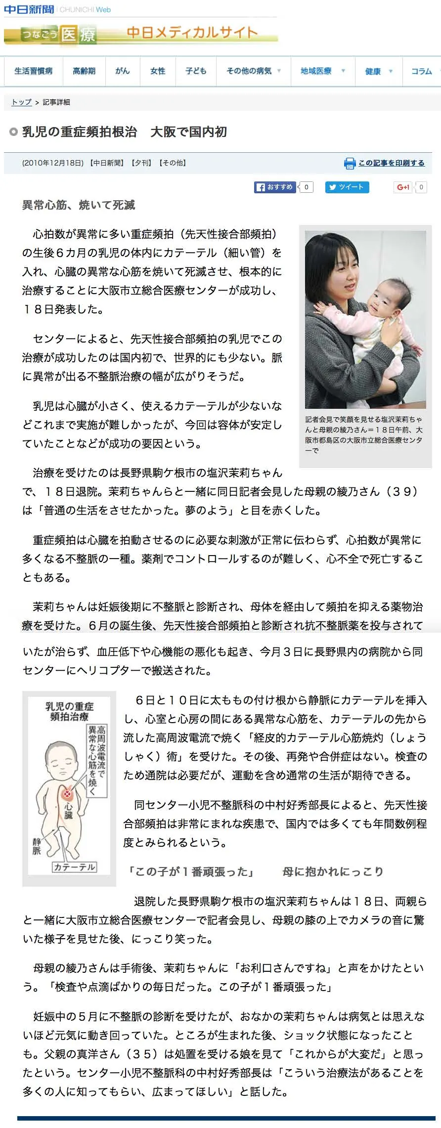 2010年12月18日 中日新聞 乳児の重症頻拍根治 大阪で国内初