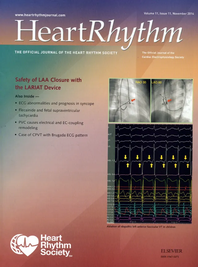 Heart Rhythm 2014年の論文の1ページ目