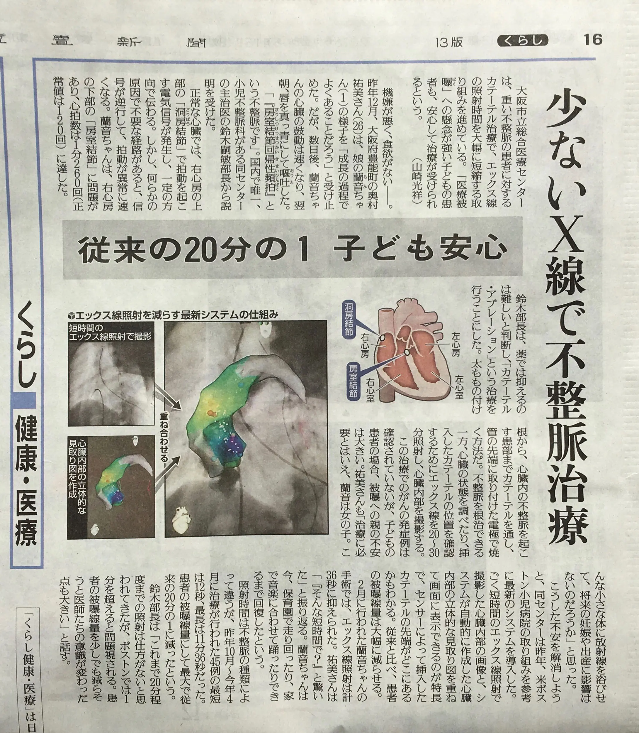 2016年5月15日 読売新聞 少ないX線で不整脈治療