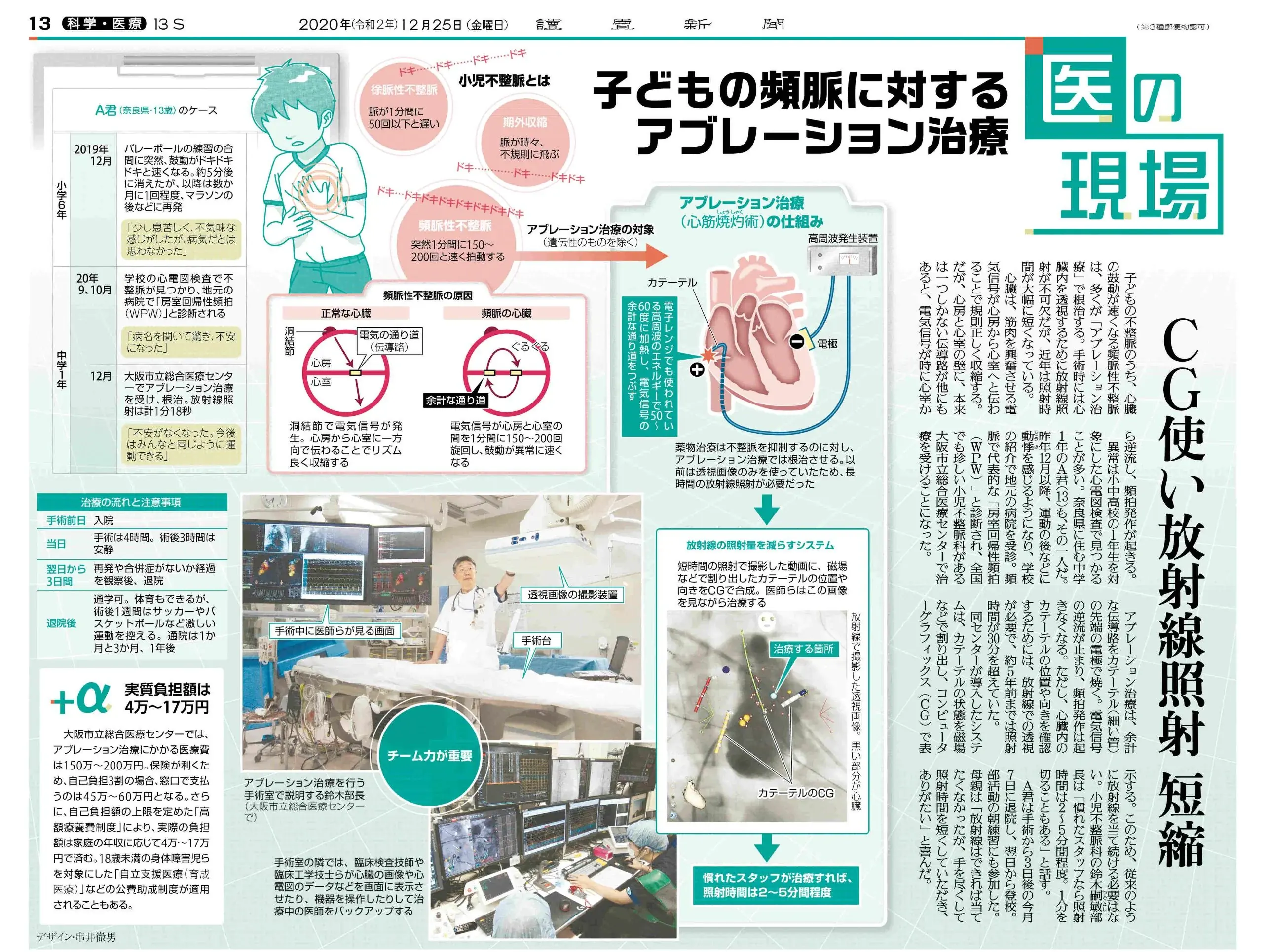 2020年12月25日 読売新聞「医の現場」子どもの頻脈に対するアブレーション治療